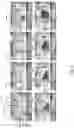 Fig. 12 - BUBBLE-FREE LIQUID FILLING OF FLUIDIC CHAMBERS