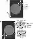 Fig. 01 - Fluidic device for the detection, capture, or removal of a disease material