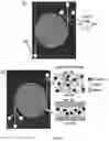 Fig. 02 - Fluidic device for the detection, capture, or removal of a disease material
