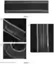 Fig. 04 - Fluidic device for the detection, capture, or removal of a disease material