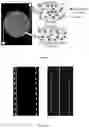 Fig. 07 - Fluidic device for the detection, capture, or removal of a disease material