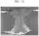 Fig. 12 - Aluminum coated blank and manufacturing method thereof