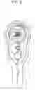 Fig. 08 - Ratchet wrench handle