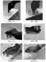 Fig. 18 - Methods for manufacturing and distributing semi-rigid acoustic coupling articles and packaging for ultrasound imaging