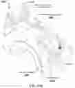 Fig. 21 - Methods for manufacturing and distributing semi-rigid acoustic coupling articles and packaging for ultrasound imaging