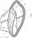 Fig. 04 - Construction of tubular assemblies