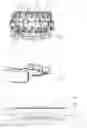 Fig. 04 - Lighting device for a motor vehicle headlight