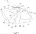 Fig. 03 - Propeller
