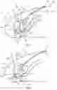 Fig. 02 - Wing leading-edge device and a wing having such a wing leading-edge device