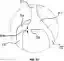 Fig. 37 - Closure cap for bottle