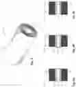 Fig. 11 - Tension-inducing shaft assemblies