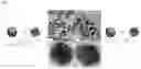 Fig. 10 - MULTI-COMPONENT MESOCRYSTALLINE NANOPARTICLES AND METHOD OF MANUFACTURING THE SAME