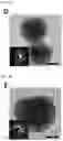 Fig. 12 - MULTI-COMPONENT MESOCRYSTALLINE NANOPARTICLES AND METHOD OF MANUFACTURING THE SAME
