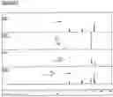 Fig. 05 - Separation, recovery and upgrading of biomass derived 2,3-butanediol