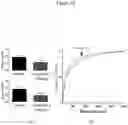 Fig. 28 - URIDINE NUCLEOSIDE DERIVATIVES, COMPOSITIONS AND METHODS OF USE