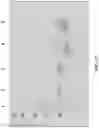 Fig. 18 - Virus-inspired compositions and methods of redirecting preexisting immune responses using the same for treatment of cancer