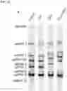 Fig. 18 - SARS-CoV-2 viruses and methods of use thereof