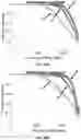 Fig. 28 - High throughput cloning of paired bipartite immunoreceptor polynucleotides and applications thereof
