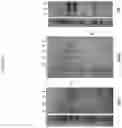 Fig. 20 - MULTISPECIFIC ANTIGEN BINDING PROTEINS