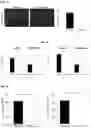 Fig. 03 - METHOD FOR TREATING A DEGENERATIVE NEUROLOGICAL DISORDERS COMPRISING ADMINISTERING ASM INHIBITOR