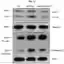 Fig. 06 - METHOD FOR TREATING A DEGENERATIVE NEUROLOGICAL DISORDERS COMPRISING ADMINISTERING ASM INHIBITOR