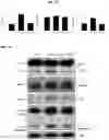 Fig. 07 - METHOD FOR TREATING A DEGENERATIVE NEUROLOGICAL DISORDERS COMPRISING ADMINISTERING ASM INHIBITOR