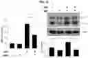 Fig. 12 - METHOD FOR TREATING A DEGENERATIVE NEUROLOGICAL DISORDERS COMPRISING ADMINISTERING ASM INHIBITOR