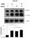 Fig. 13 - METHOD FOR TREATING A DEGENERATIVE NEUROLOGICAL DISORDERS COMPRISING ADMINISTERING ASM INHIBITOR