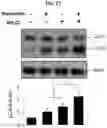 Fig. 14 - METHOD FOR TREATING A DEGENERATIVE NEUROLOGICAL DISORDERS COMPRISING ADMINISTERING ASM INHIBITOR