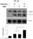 Fig. 15 - METHOD FOR TREATING A DEGENERATIVE NEUROLOGICAL DISORDERS COMPRISING ADMINISTERING ASM INHIBITOR