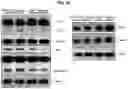 Fig. 21 - METHOD FOR TREATING A DEGENERATIVE NEUROLOGICAL DISORDERS COMPRISING ADMINISTERING ASM INHIBITOR