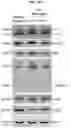 Fig. 24 - METHOD FOR TREATING A DEGENERATIVE NEUROLOGICAL DISORDERS COMPRISING ADMINISTERING ASM INHIBITOR