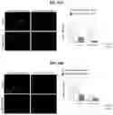 Fig. 29 - METHOD FOR TREATING A DEGENERATIVE NEUROLOGICAL DISORDERS COMPRISING ADMINISTERING ASM INHIBITOR