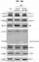Fig. 34 - METHOD FOR TREATING A DEGENERATIVE NEUROLOGICAL DISORDERS COMPRISING ADMINISTERING ASM INHIBITOR
