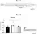 Fig. 36 - METHOD FOR TREATING A DEGENERATIVE NEUROLOGICAL DISORDERS COMPRISING ADMINISTERING ASM INHIBITOR