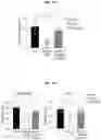 Fig. 46 - METHOD FOR TREATING A DEGENERATIVE NEUROLOGICAL DISORDERS COMPRISING ADMINISTERING ASM INHIBITOR