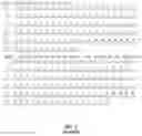 Fig. 04 - ANTIBODIES TO OXIDATION-SPECIFIC EPITOPES