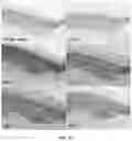 Fig. 17 - ANTIBODIES TO OXIDATION-SPECIFIC EPITOPES