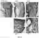 Fig. 18 - ANTIBODIES TO OXIDATION-SPECIFIC EPITOPES