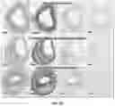 Fig. 22 - ANTIBODIES TO OXIDATION-SPECIFIC EPITOPES