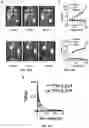 Fig. 25 - ANTIBODIES TO OXIDATION-SPECIFIC EPITOPES