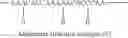 Fig. 04 - Multi-component ionomer
