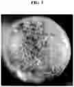 Fig. 03 - METHOD OF RECYCLING INSOLE SCRAP, PULVERIZED INSOLE SCRAP, AND FOAM FOR SHOE MANUFACTURED THEREBY