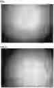 Fig. 02 - METHOD FOR PRODUCING POLYMER COMPATIBLE WITH BIOMATERIALS