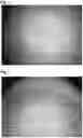 Fig. 03 - METHOD FOR PRODUCING POLYMER COMPATIBLE WITH BIOMATERIALS