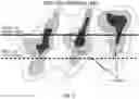 Fig. 03 - Method of mitigating frac hit production interference from adjacent oil wells using treatment fluids with nanoparticles