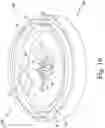 Fig. 17 - BIOFABRICATION SYSTEM