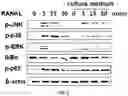 Fig. 04 - COMPOSITION COMPRISING LACTOBACILLUS SAKEI CVL-001 OR CULTURE LIQUID THEREOF FOR ALLEVIATING, PREVENTING, OR TREATING BONE DISEASES OR METABOLIC DISEASES