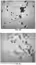 Fig. 04 - METHODS FOR DETECTING DISEASES AND DISORDERS CHARACTERIZED BY ABERRANT RED BLOOD CELL AGGREGATION