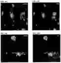 Fig. 22 - Methods of using PDX1-positive pancreatic endoderm cells and endocrine precursor cells
